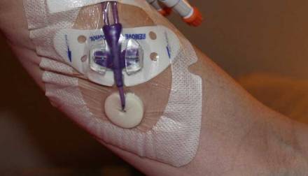 PICC Insertion | Infusion Nurse Blog